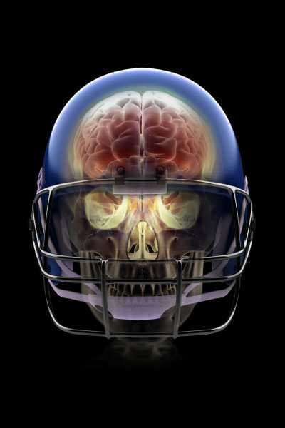 What a lifetime of playing football can do to the human brain