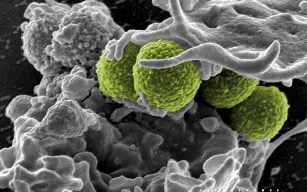 Million-Year-Old 'Zombie' Bacteria Living in Deep Earth a 'Challenge to Science'