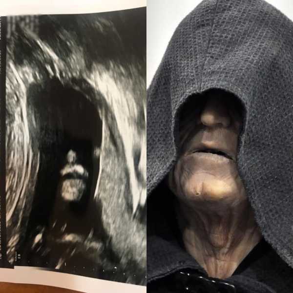 Netizens Recognise Darth Sidious in Ultrasound Pic of Unborn Baby