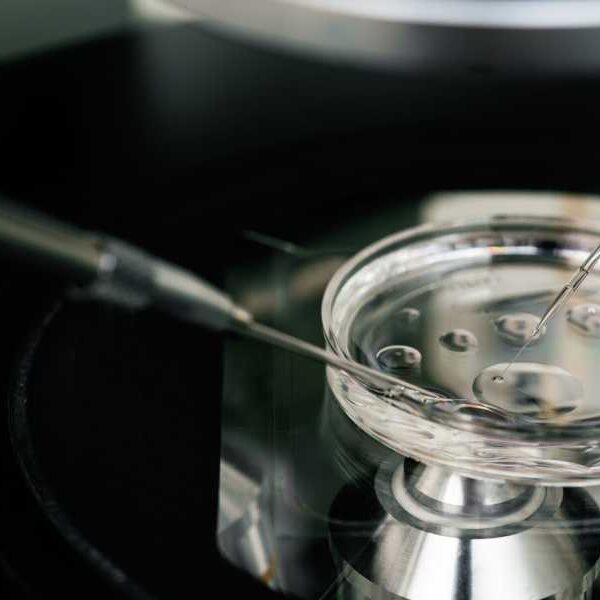 Alabama Sets the Stage for a Supreme Court Fight Over IVF