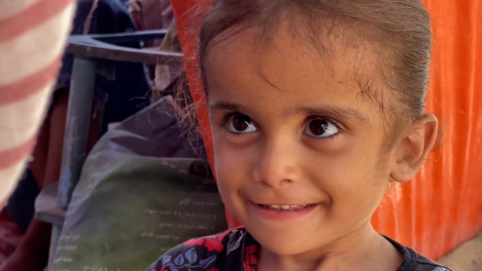 Video Gaza’s silent crisis: A child’s battle against malnutrition