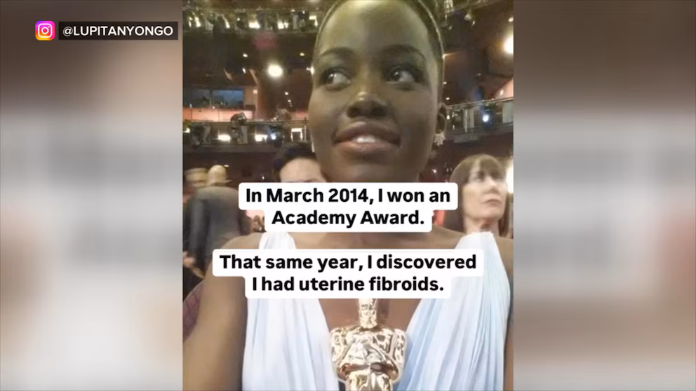 Video Oscar-winning actress Lupita Nyong’o shares experience with uterine fibroids