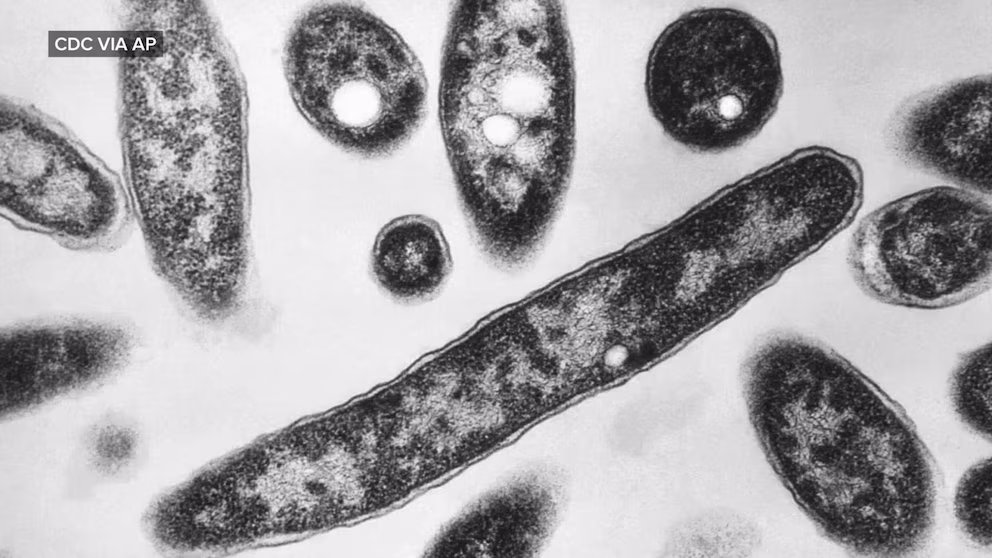 Video What to know about Legionnaires’ disease