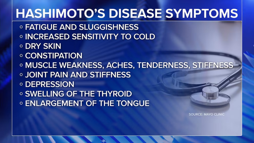 Video Signs and symptoms of Hashimoto’s disease