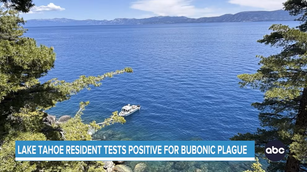 Video California resident tests positive for plague