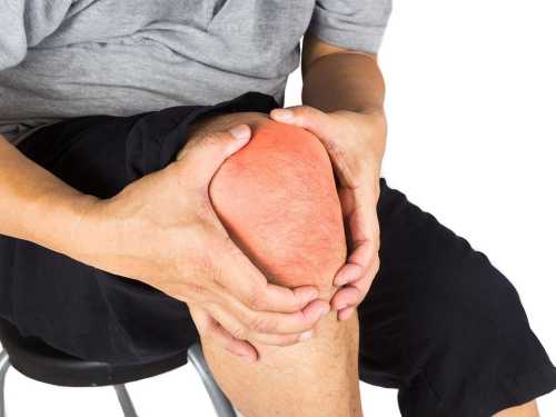 A crunch in your knees isn't always arthritis: what this sound really means for your joints