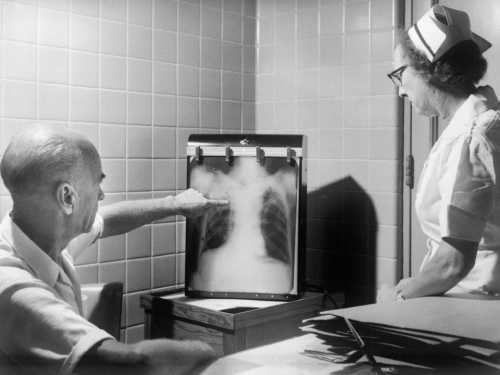 Ventilation is more important than you think: Study proves that tuberculosis DNA lingers indoors for a long time