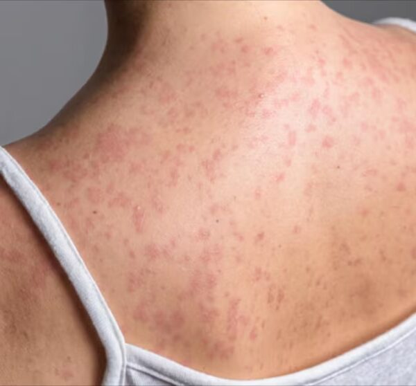 Healthy Heart: Key Insights