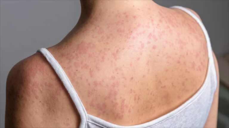 Healthy Heart: Key Insights 7