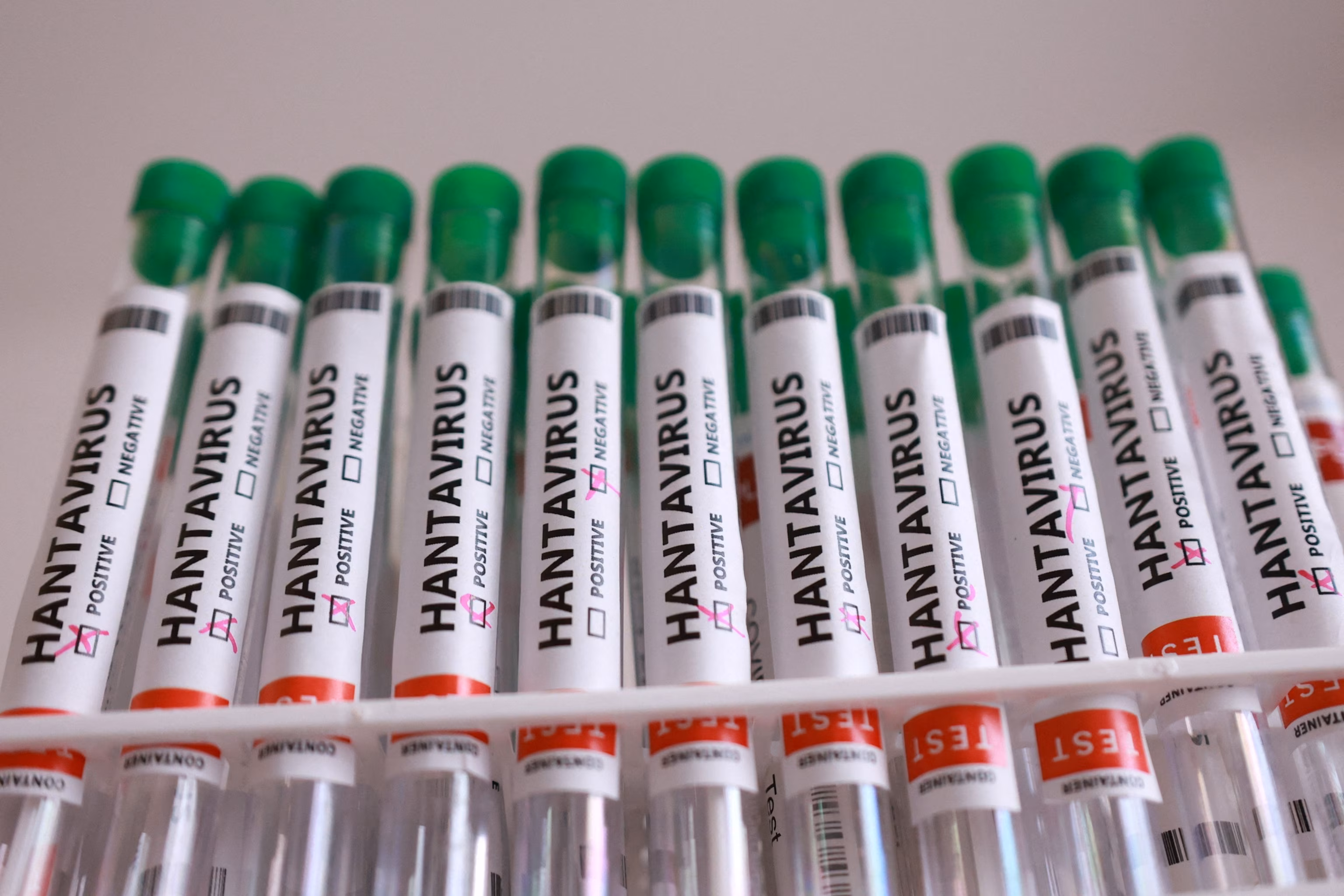 Colorado Health Authorities Probe Hantavirus Fatality; Not Connected to Cruise Outbreak. 4