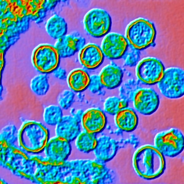 Hantavirus: Cruise Ship Outbreak Concerns