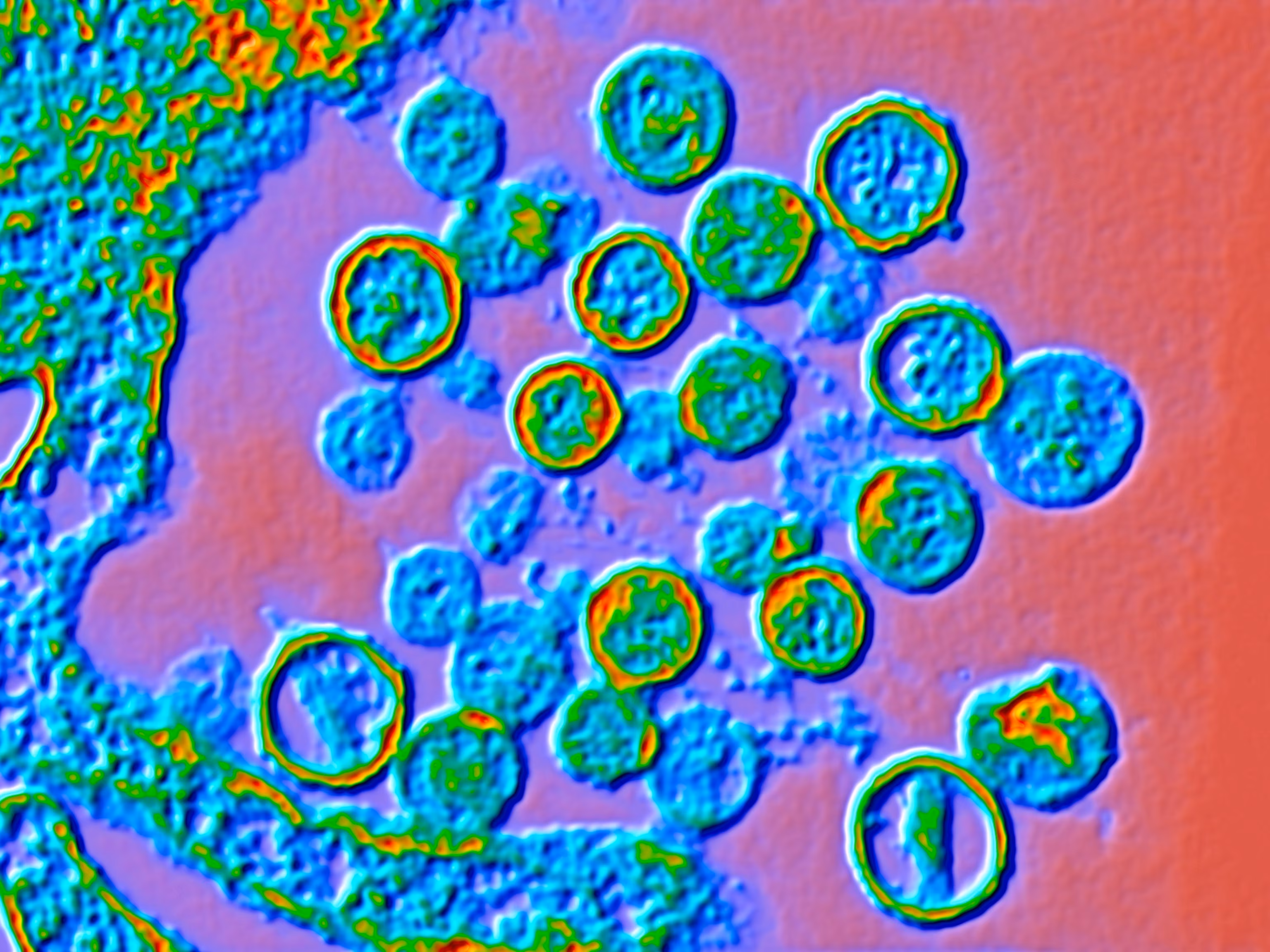 Hantavirus: Cruise Ship Outbreak Concerns 3