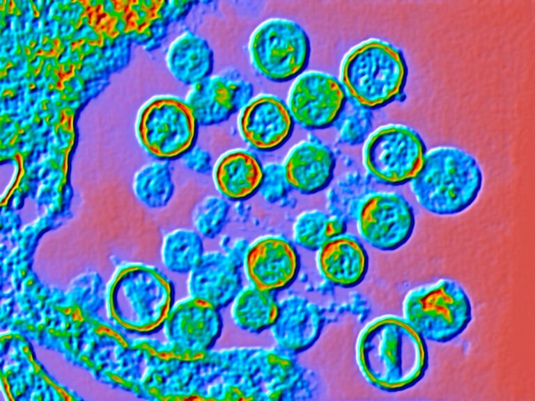 Hantavirus: Cruise Ship Outbreak Raises Concerns 14