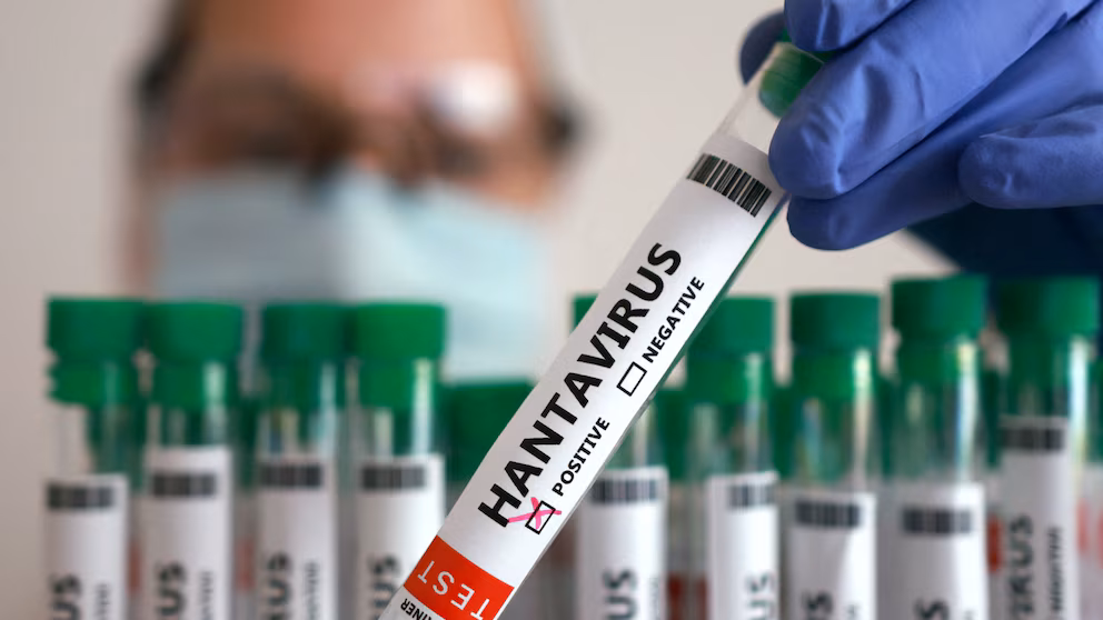 Hantavirus: Fleeting, intimate transmission only, say authorities. 5