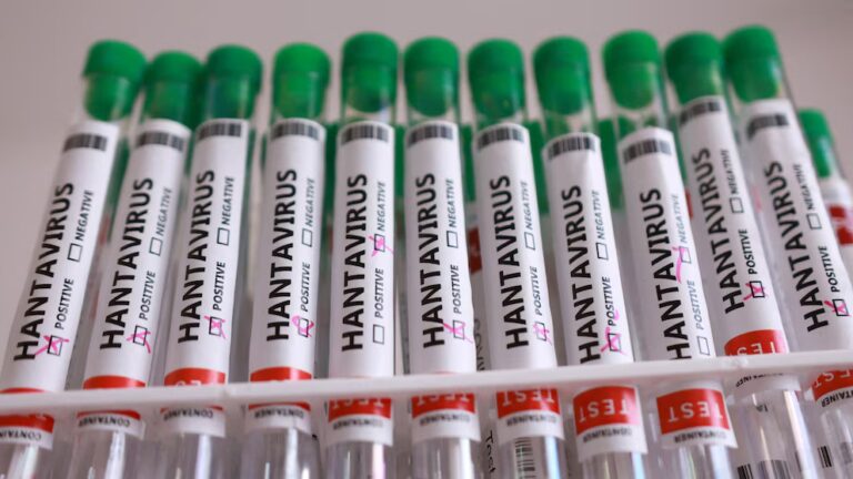 Colorado Health Authorities Probe Hantavirus Fatality; Not Connected to Cruise Outbreak. 1