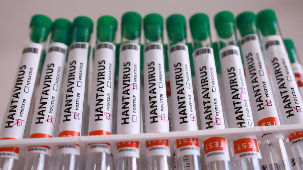 Colorado Health Authorities Probe Hantavirus Fatality; Not Connected to Cruise Outbreak. 3