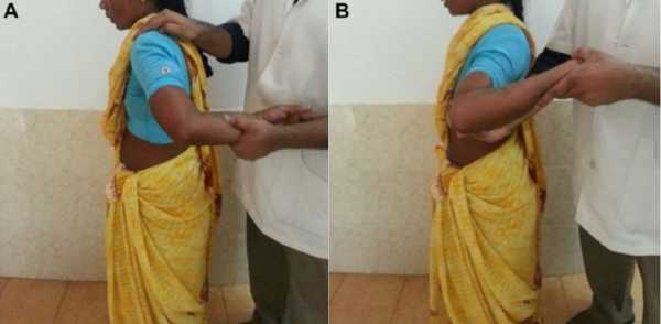 Meet Indian Woman Who Can Rotate Her Arm 180 Degrees (PHOTO)